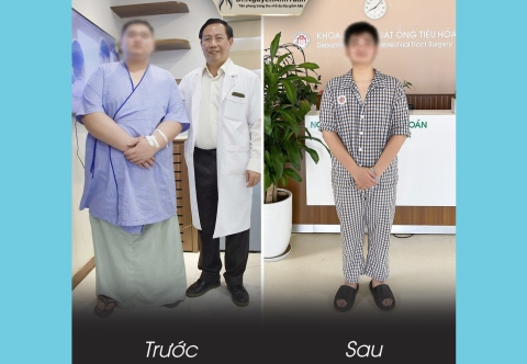 Quán quân giảm béo bằng phương pháp thu nhỏ dạ dày